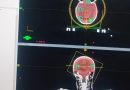 ‎MTRH Conducts its First Stereotactic Radiosurgery (SRS)